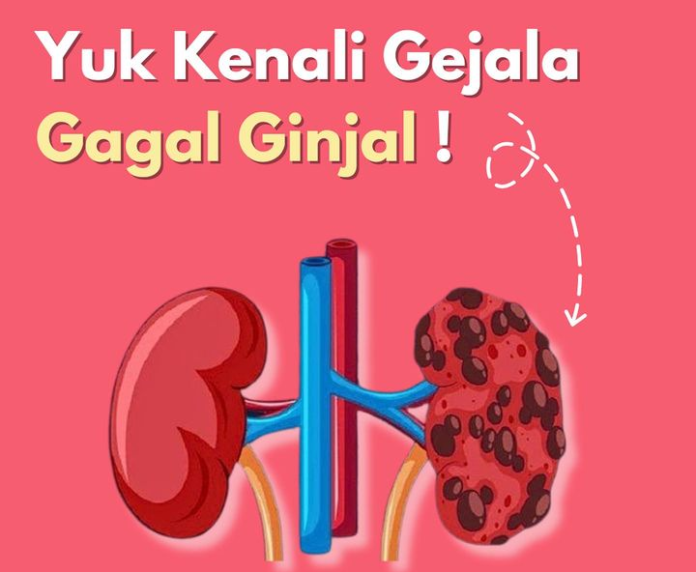 Kenali Gejala Gagal Ginjal Dari Dokter RSD Idaman 