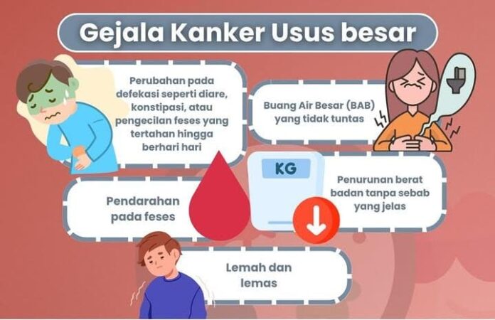 faktor risiko kanker usus besar